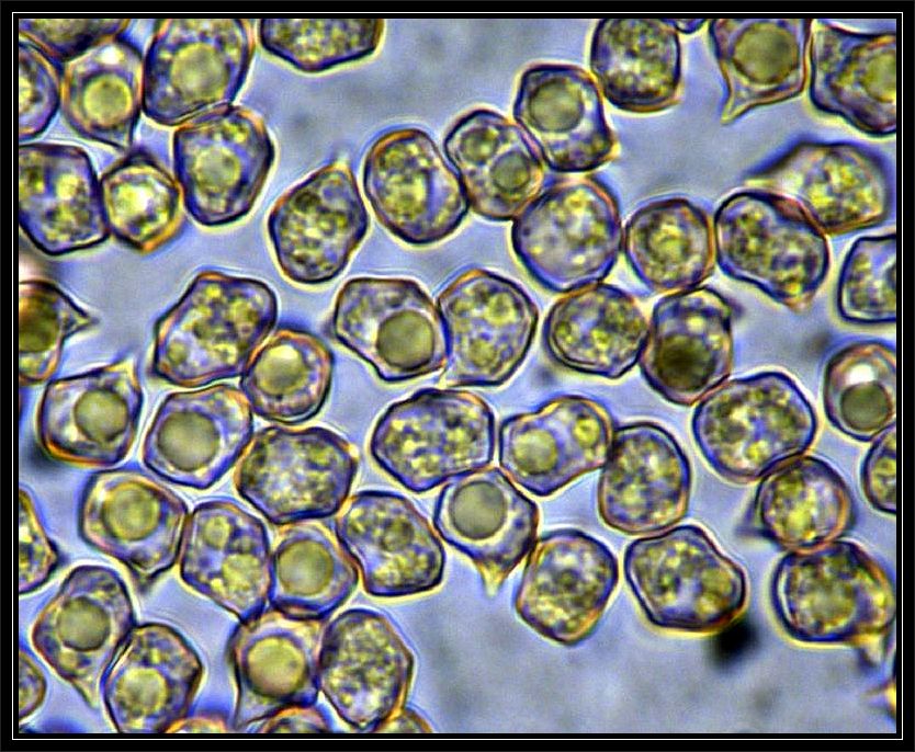 Dieses schöne Sporenbild von Entoloma rhodopolium, dem Niedergedrückten Rötling haben wir Christopher Engelhardt aus Lübeck zu verdanken. Wir haben die Pilze am Sonntag am Neumühler See gefunden, waren uns aber nicht sicher.