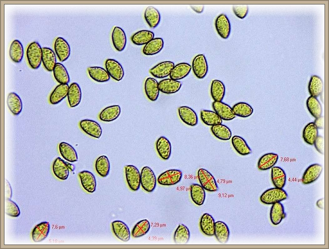 Hier die Sporen von Cortinarius langei. Präparat und Foto von Christopher Engehardt.