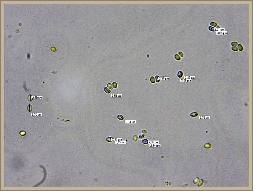 Die mikroskopische Untersuchung von Christopher bestätigte unsere Vermutung. Die Art beisitzt besonders kleine, charakteristische Sporen.