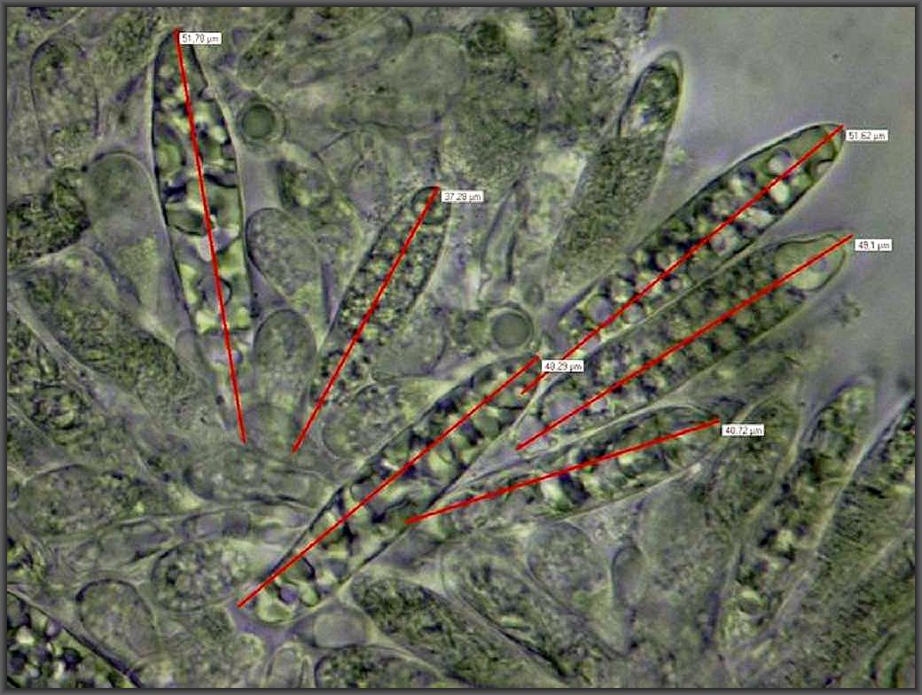 Hier eine Mikroaufnahme von Christopher Engehardt. Die Größenordnungen der Cheilo - Zystiden sprech für Russula fragilis.